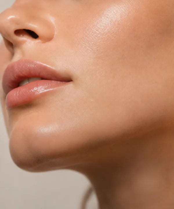 Close-up of lips and facial contour during a filler treatment